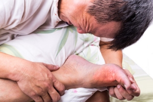 Specific Foods May Lead to Gout
