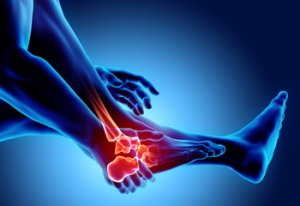 Types of Arthritis