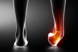 When Ankle Sprains Do Not Heal Properly 
